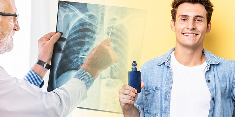 Man with vape next to lung scan.